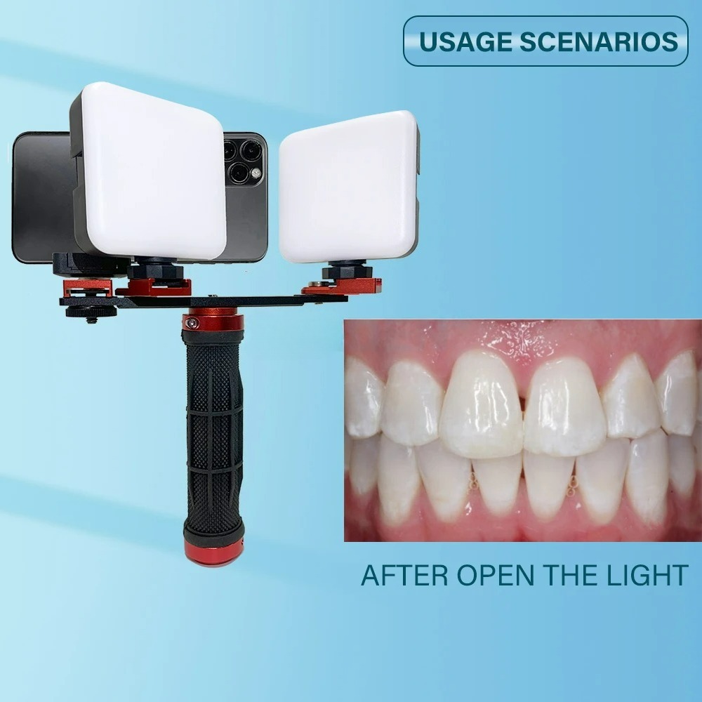 Luce per Fotografia Dentale co - Photography Dental recensione e prezzo