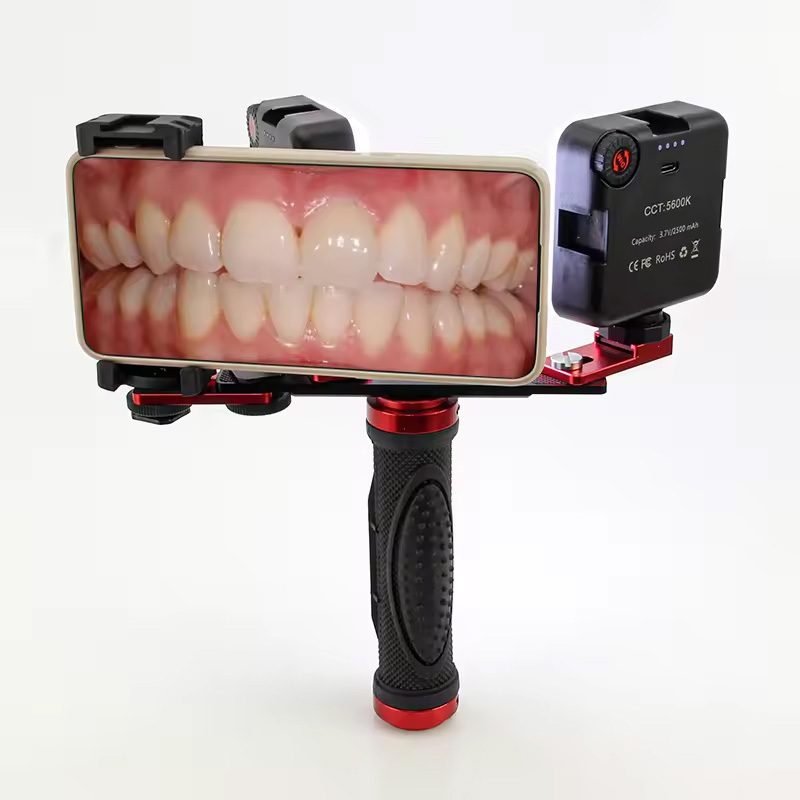 Lampada LED per Fotografia Den - Photography Dental recensione e prezzo