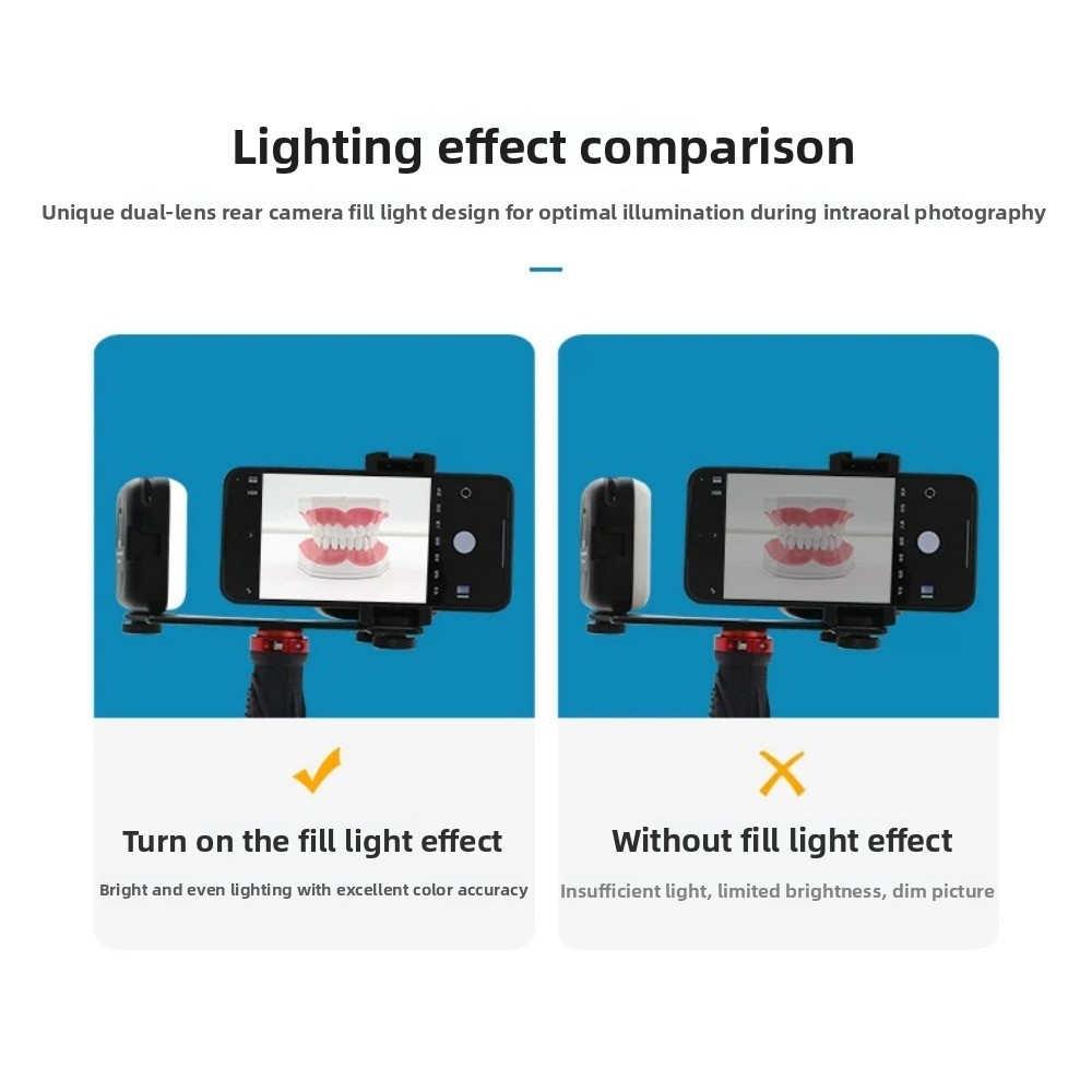 Luce per fotografia dentale, f - Photography Basics recensione e prezzo