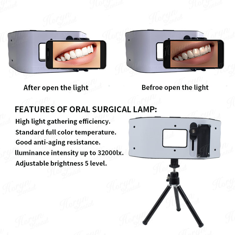 Luce flash dentale Attrezzatur - Photography Dental recensione e prezzo